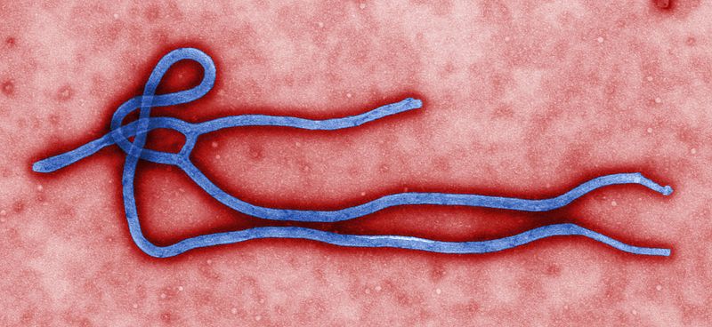 File:Ebola virus virion.jpg - Wikipedia, the free encyclopedia